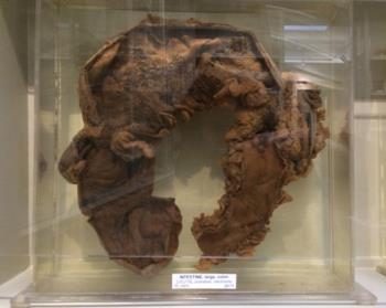 LARGE INTESTINE, colon